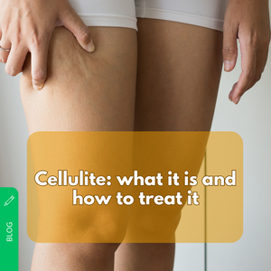 Cellulite: what it is and how to treat it